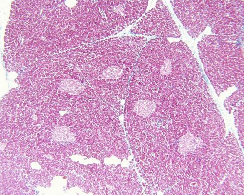 Модифицированные гепатоциты избавили мышей от диабета