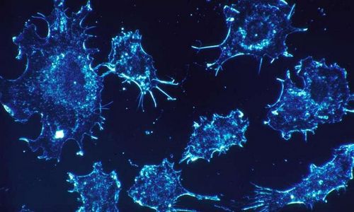 Новые достижения наномедицины останавливают прогрессирование рака поджелудочной железы